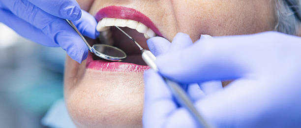 Best Emergency Dental Services for Seniors in Apple Valley, OH